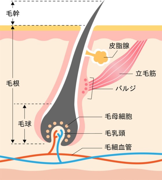 長崎・大村・諫早エリアで医療脱毛を提供している上田皮ふ科の医療脱毛の仕組み説明図